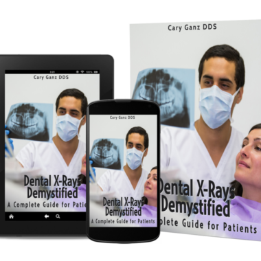 Dental X-Rays Demystified: A Complete Guide for Patients