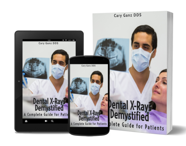 Dental X-Rays Demystified: A Complete Guide for Patients