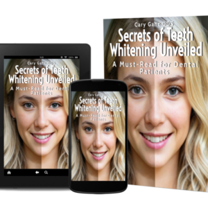 Secrets of Teeth Whitening Unveiled: A Must-Read for Dental Patients