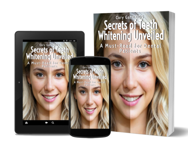 Secrets of Teeth Whitening Unveiled: A Must-Read for Dental Patients